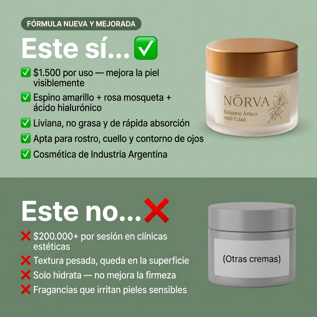 NÖRVA comparativa este sí este no