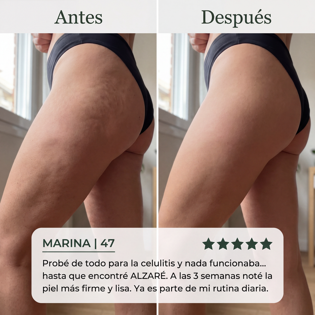 ALZARÉ® Tratamiento Reafirmante & Anti Celulitis — Crema Corporal 250 g