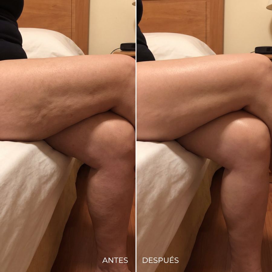 Foto antes y después de Patricia L., 69